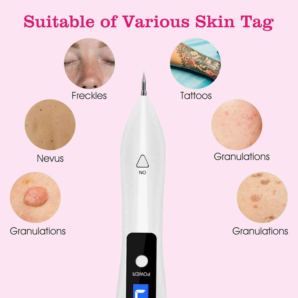 Skin Tag Removal Device