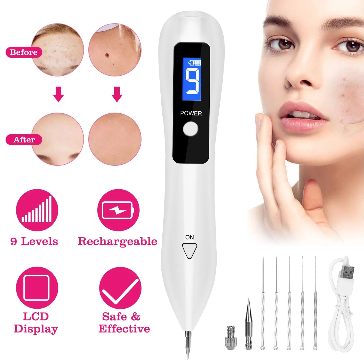 Skin Tag Removal Device