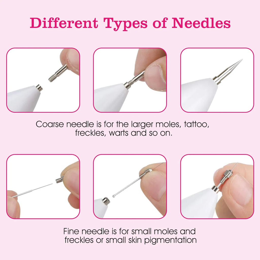 Skin Tag Removal Device