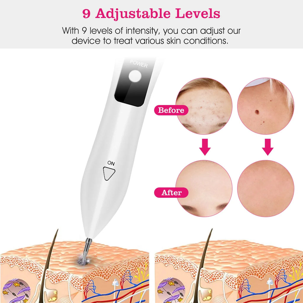 Skin Tag Removal Device